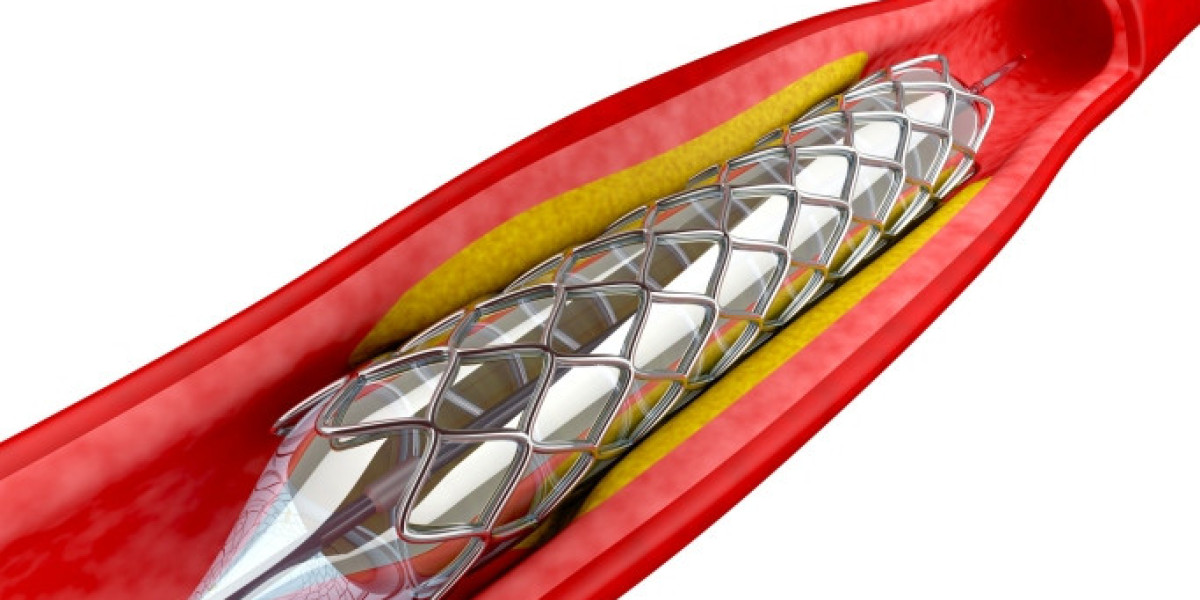 Angioplasty Balloon Market Size, Trends, Opportunity, Overview and Forecast by 2031