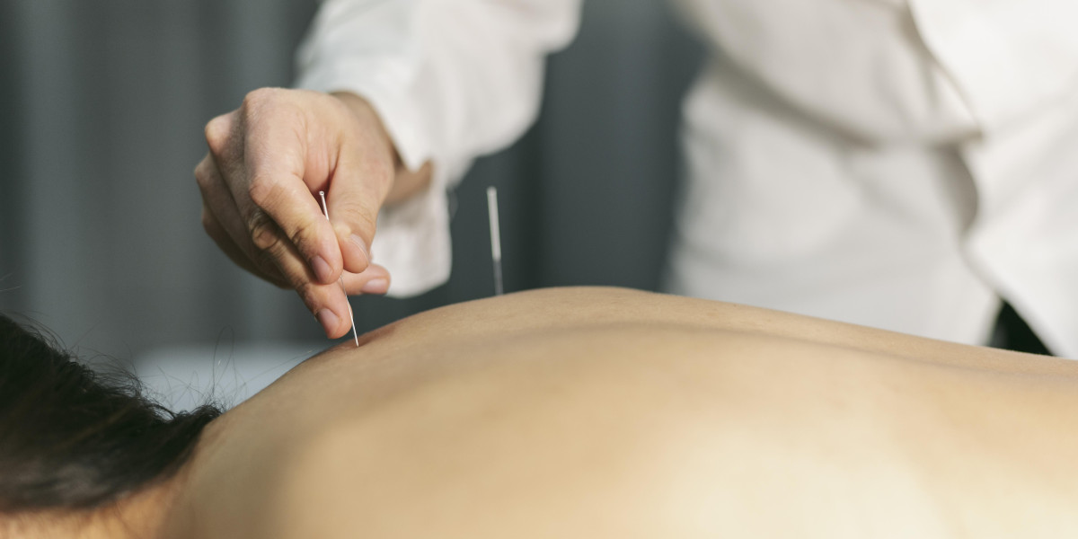 Acupuncture for Infertility: A Natural Approach to Enhancing Fertility